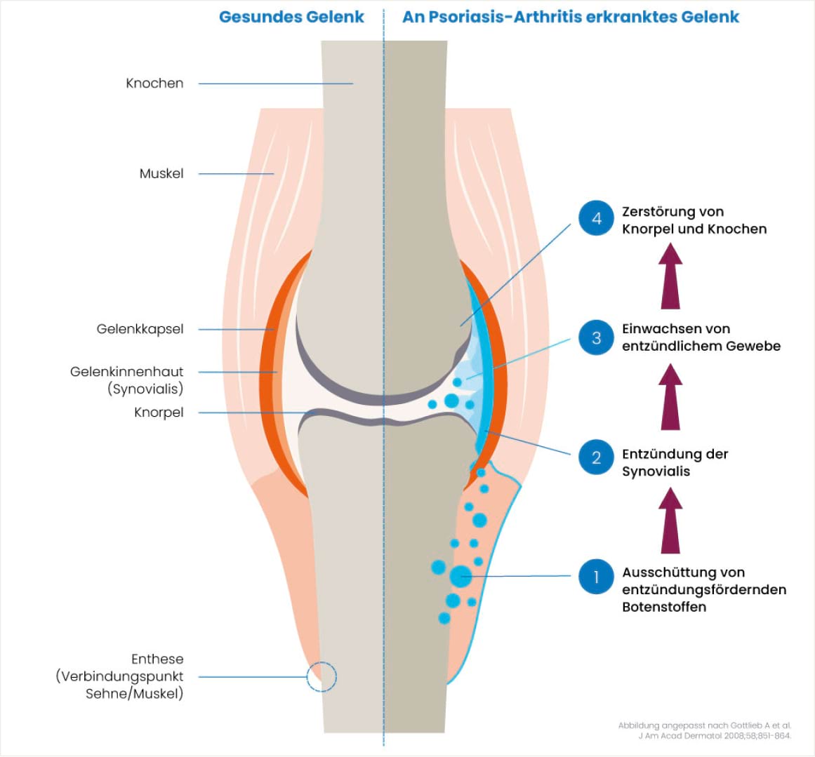 bone joint